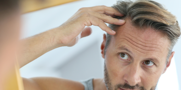 ¿Cómo se hace el injerto de cabello?